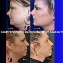 Diferença do antes e depois