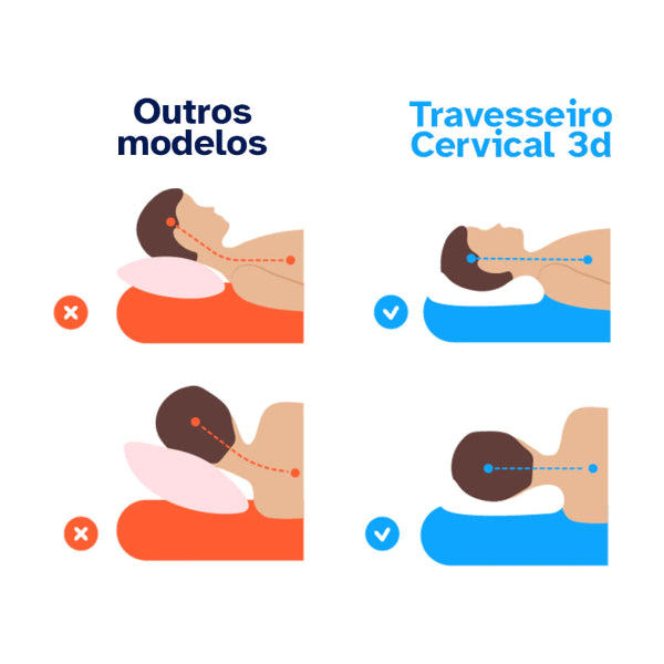 Travesseiro Ortopédico Cervical-a diferença